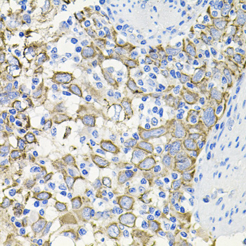 Anti-ACVR2A Antibody (CAB1981)