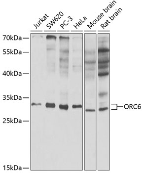 Anti-ORC6 Antibody (CAB5426)