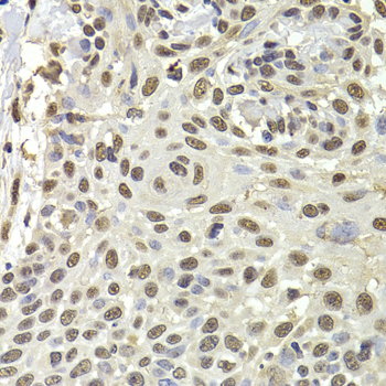 Anti-PUF60 Antibody (CAB6709)