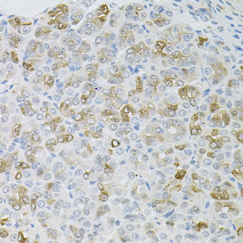 Anti-HPS1 Antibody (CAB6621)