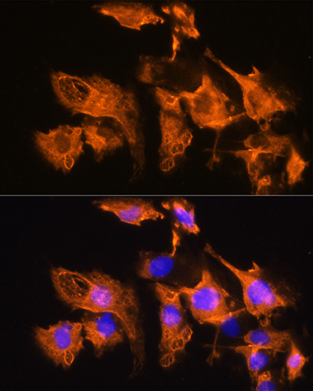 Anti-ARF4 Antibody (CAB7644)