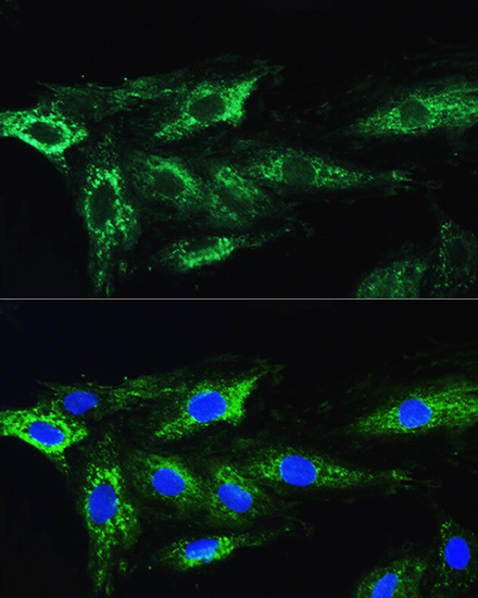 Anti-ATG16L1 Antibody (CAB11969)