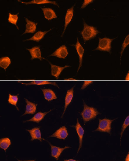 Anti-GBAS Antibody (CAB17888)