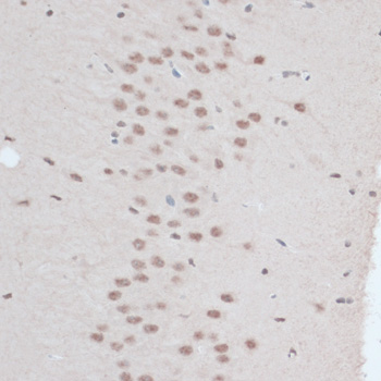 Anti-ZNF416 Antibody (CAB14910)