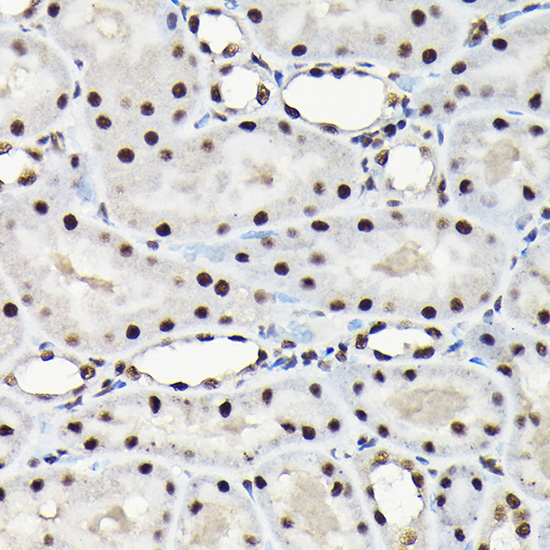 Anti-EFTUD2 Antibody (CAB7040)