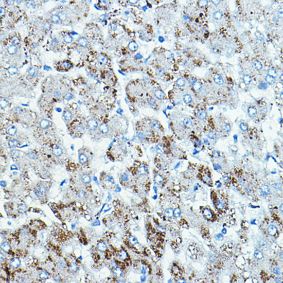 Anti-BRAF Antibody (CAB15033)