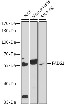Anti-FADS1 Antibody (CAB16306)