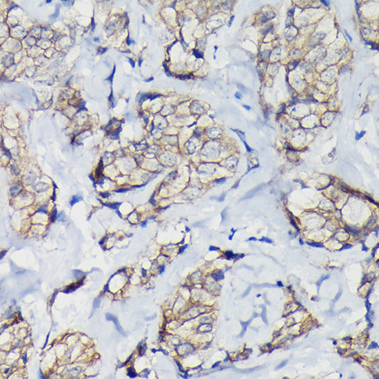 Anti-Beta-Catenin Antibody [KO Validated] (CAB11512)