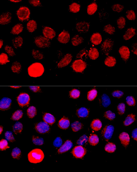 Anti-BAZ1A Antibody (CAB16495)