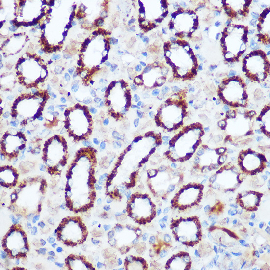 Anti-PDHA1 Antibody (CAB17432)