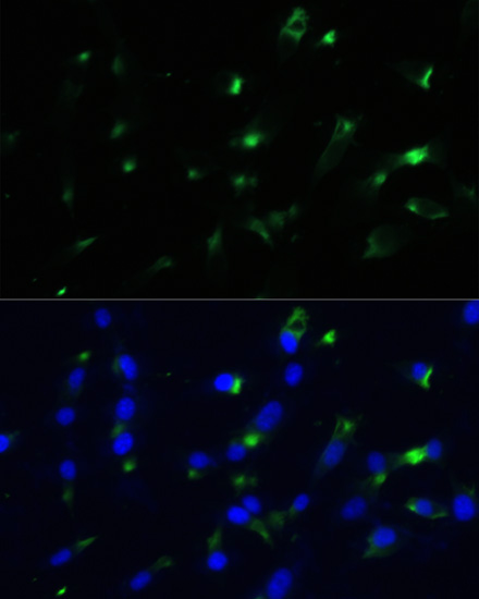 Anti-ENO1 Antibody [KO Validated] (CAB1033)