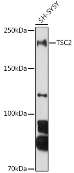 Anti-TSC2 Antibody (CAB0492)