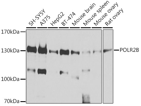 Anti-POLR2B Antibody (CAB5928)