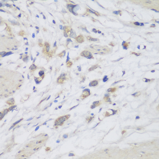 Anti-CEMIP Polyclonal Antibody (CAB8587)