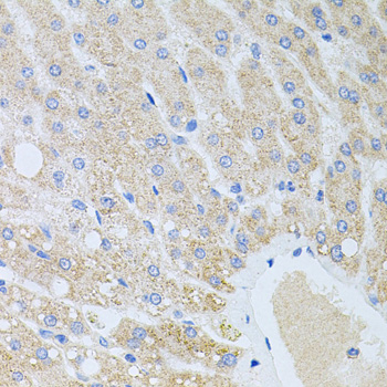 Anti-DLK1 Antibody (CAB6578)