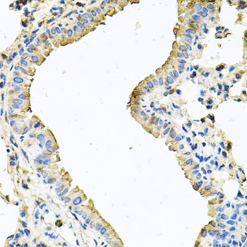 Anti-CHCHD3 Polyclonal Antibody (CAB8584)