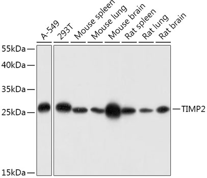 Anti-TIMP2 Antibody (CAB1558)