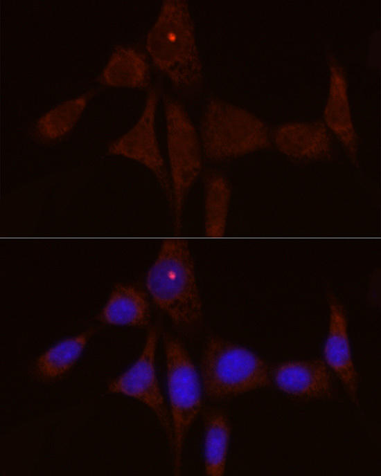 Immunofluorescence analysis of NIH/3T3 cells using IL1RN Rabbit pAb at dilution of 1:50 (40x lens). Blue: DAPI for nuclear staining.