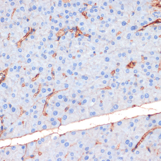 Anti-Phospho-eNOS-S1177 Antibody (CABP0515)