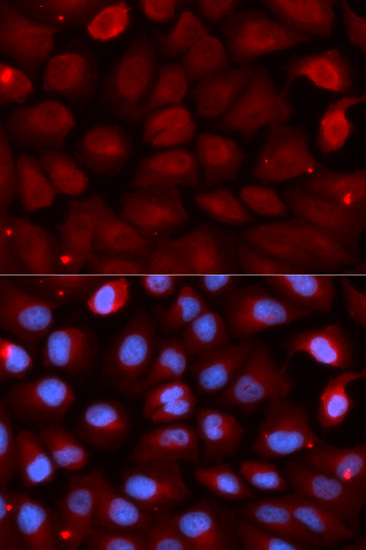 Anti-FMR1 Antibody (CAB5645)