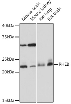 Anti-RHEB Antibody (CAB3702)