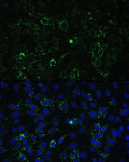 Anti-ALDH1A2 Antibody (CAB7503)