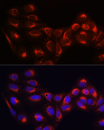 Anti-HK1 Antibody [KO Validated] (CAB1054)