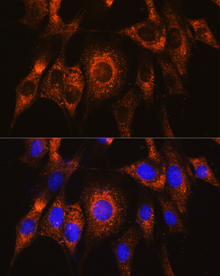 Anti-UBAC2 Antibody (CAB15975)