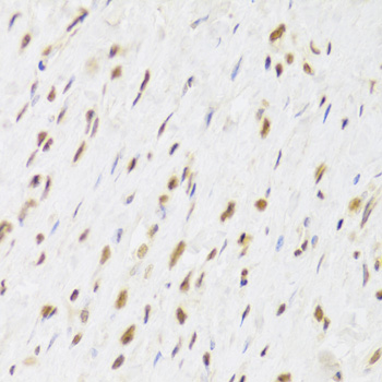 Anti-RUVBL1 Antibody (CAB5723)