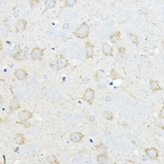 Anti-GIPR Polyclonal Antibody (CAB9816)