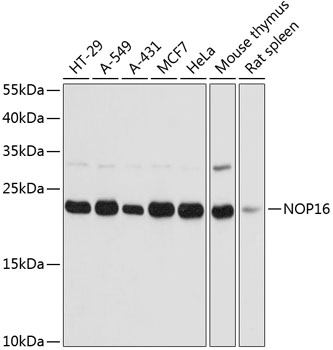 Anti-NOP16 Antibody (CAB14128)