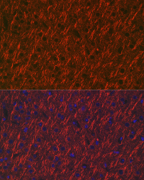 Anti-MAP2 Antibody (CAB2572)