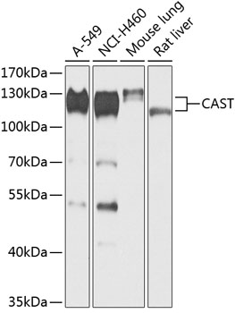 Anti-CAST Antibody (CAB13683)