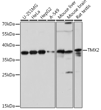 Anti-TMX2 Antibody (CAB17148)