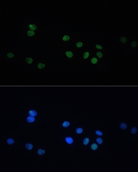 Anti-FITC Goat Anti-Mouse IgG (H+L) Antibody (CABS001)