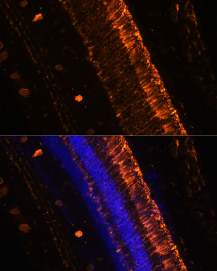 Anti-KCNS2 Antibody (CAB15684)