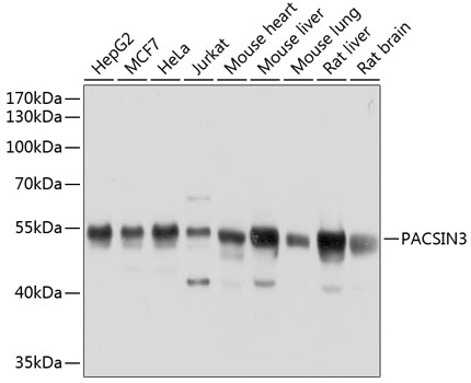 Anti-PACSIN3 Polyclonal Antibody (CAB8647)