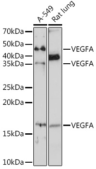 Anti-VEGFA Antibody (CAB17000)