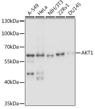 Anti-AKT1 Antibody (CAB5523)