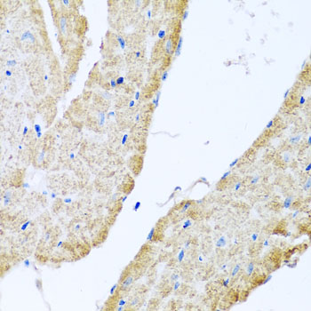 Anti-COX6B1 Antibody (CAB2641)