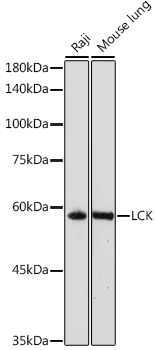 Anti-LCK Antibody (CAB2177)