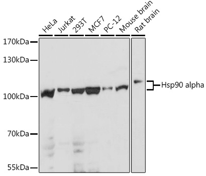 Anti-Hsp90 alpha Antibody (CAB12448)