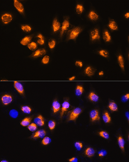 Anti-ARRB2 Antibody (CAB1171)