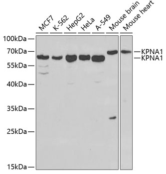 Anti-KPNA1 Antibody (CAB1742)