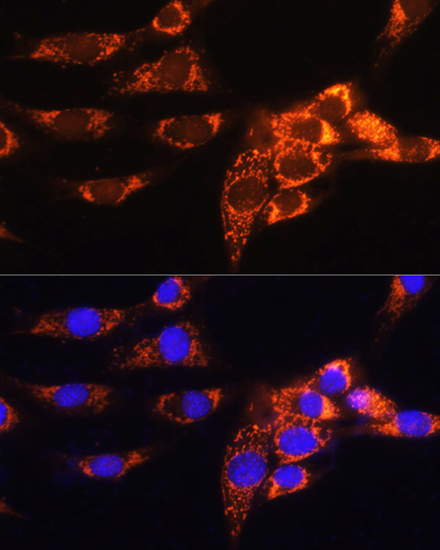 Anti-AMPD1 Antibody (CAB3584)