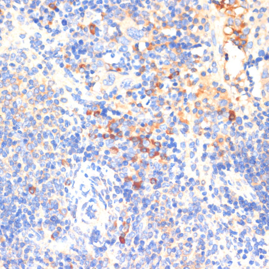 Anti-WNK3 Antibody (CAB5574)