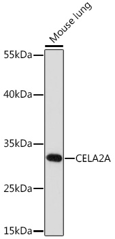 Anti-CELA2A Antibody (CAB17200)