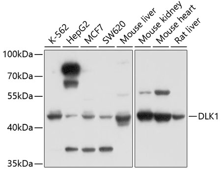 Anti-DLK1 Antibody (CAB2715)