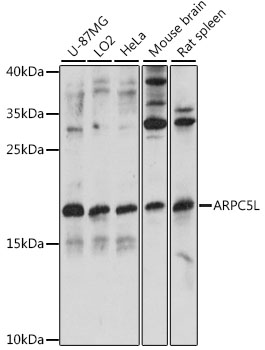 Anti-ARPC5L Antibody (CAB15904)