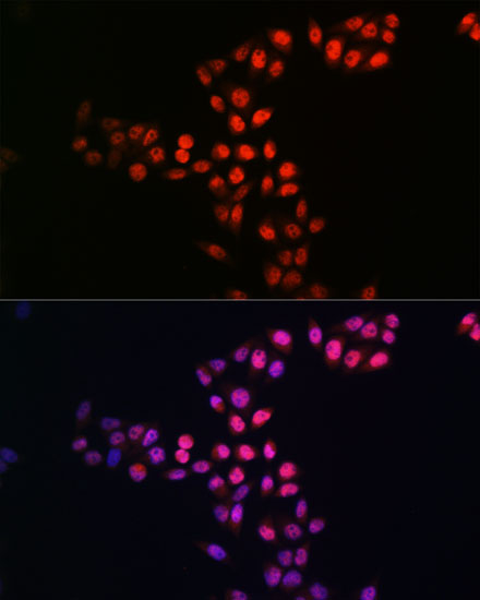 Anti-SIRT1 Antibody [KO Validated] (CAB19667)